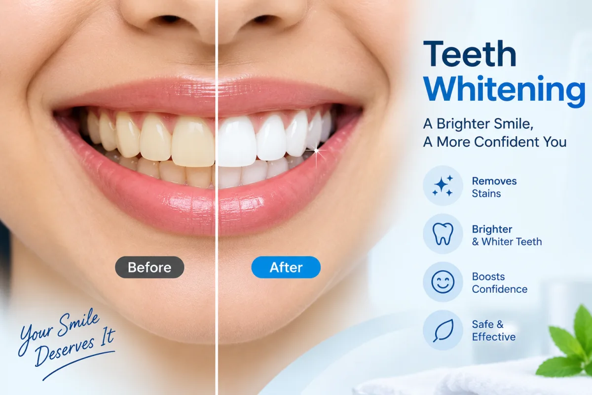 Teeth Whitening