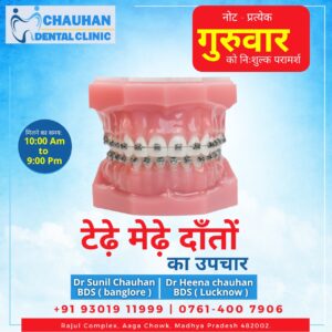 Braces for teeth at Dr. Chauhan's Dental Clinic
