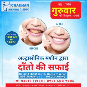Teeth Cleaning at Dr. Chauhan's Dental Clinic